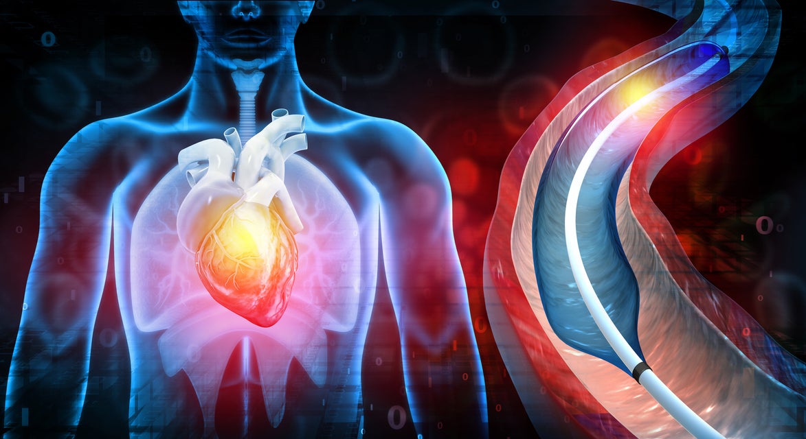 Interventional Pulmonology