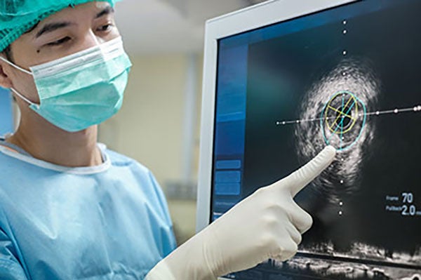 Vascular Ultrasound