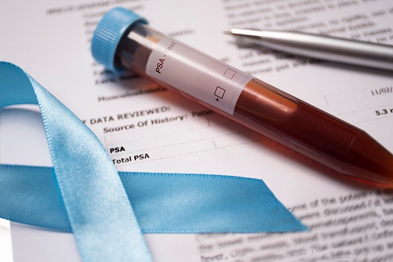 PSA test