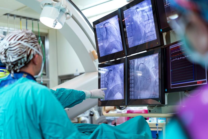General Cardiac Care