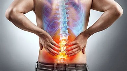 Which Exercise Regimen Works Best to Ease Lower Back Pain