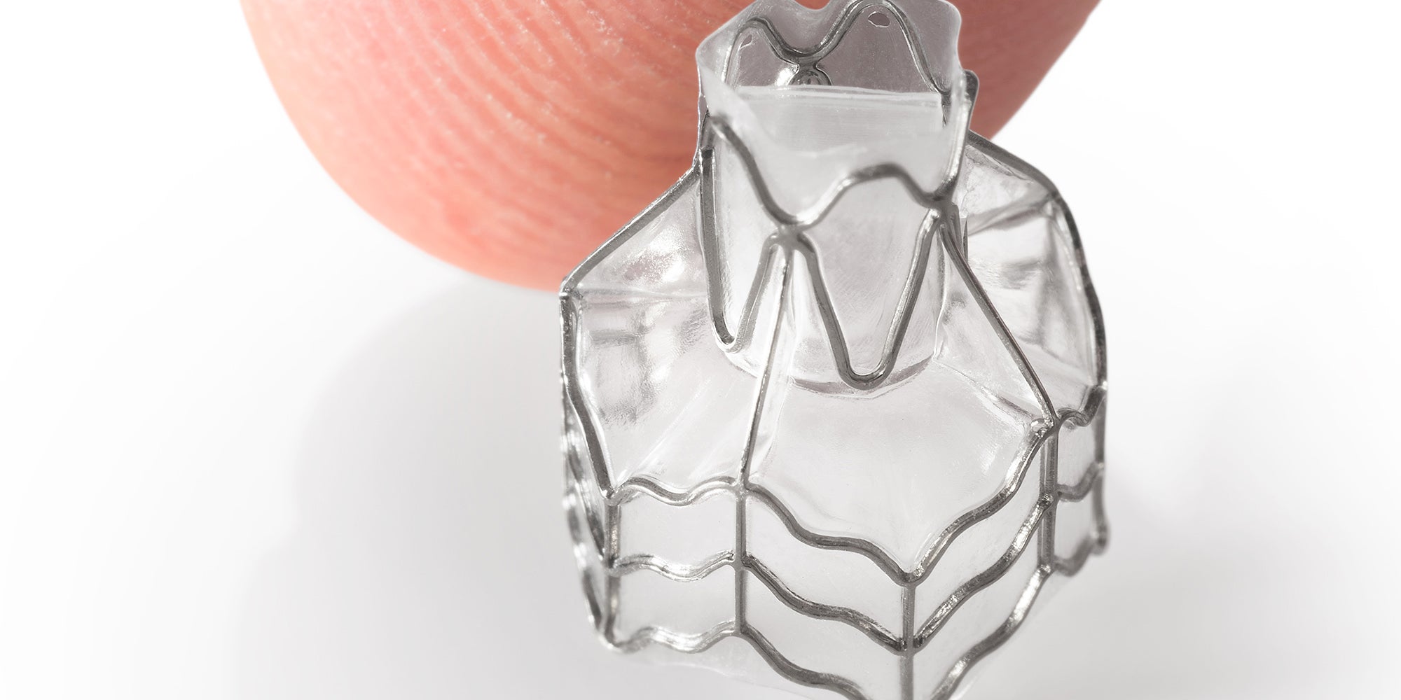 Endobronchial Valves