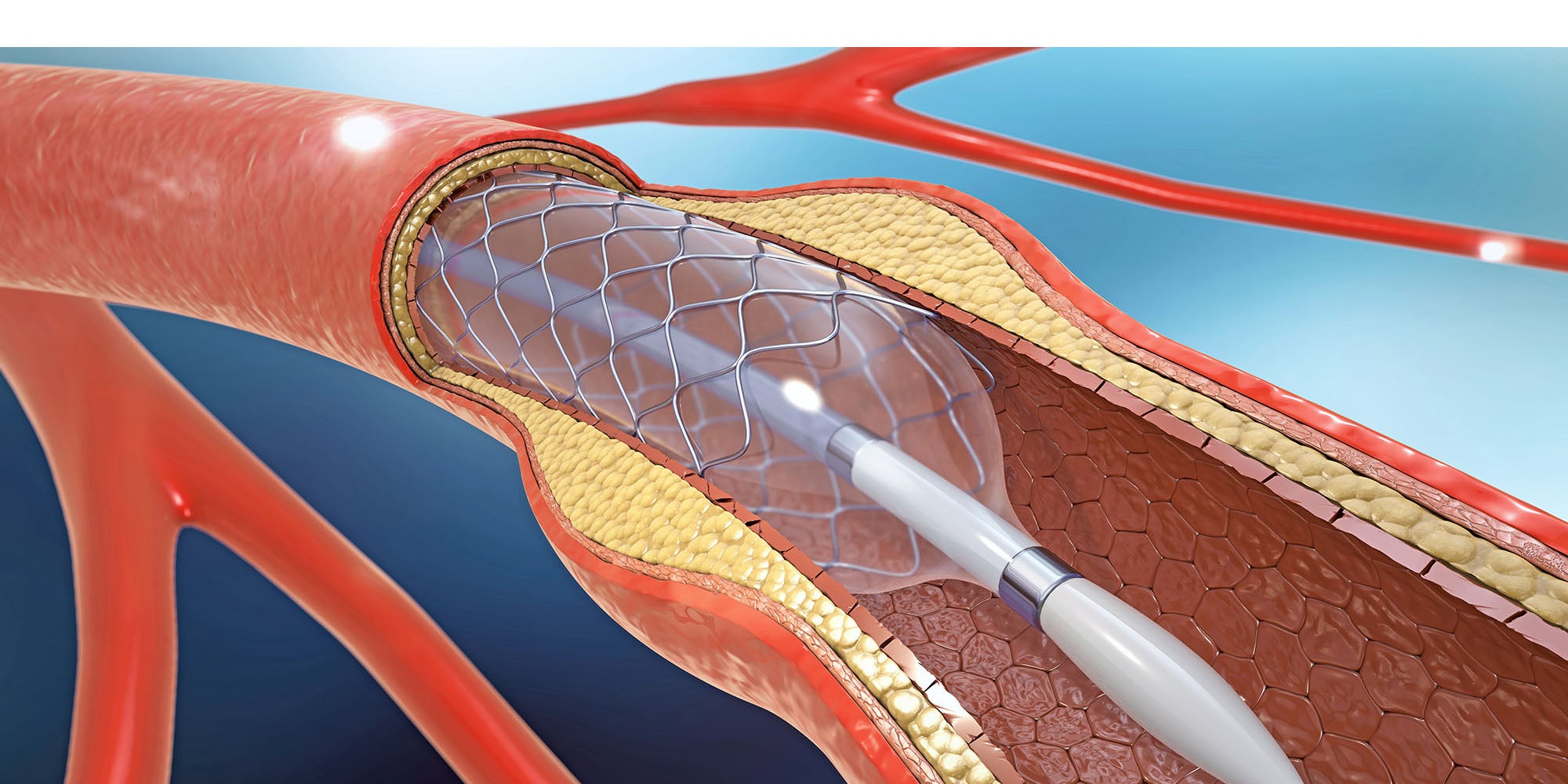 Advanced Cardiac Care