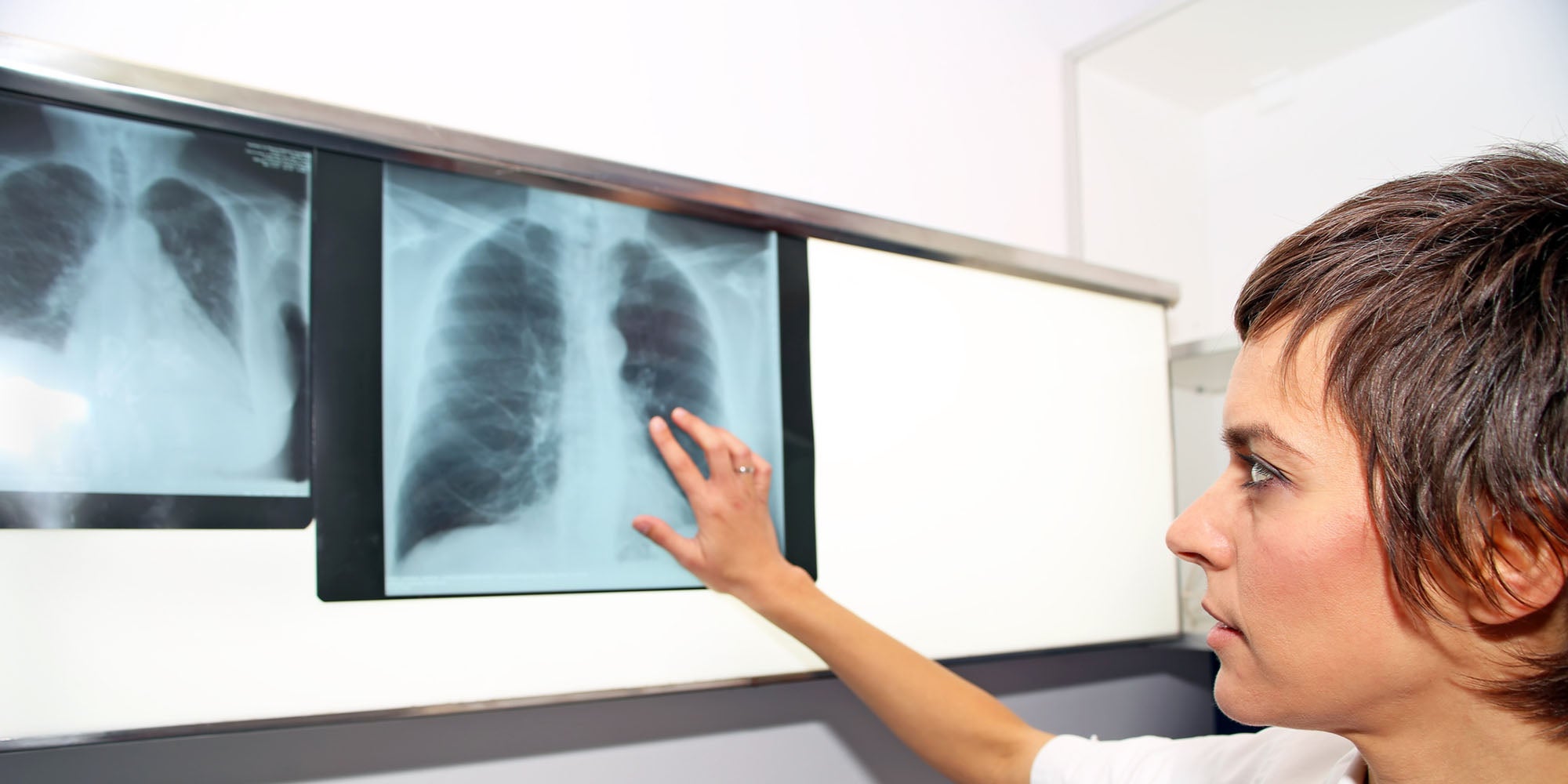 Pulmonary Embolism Response
