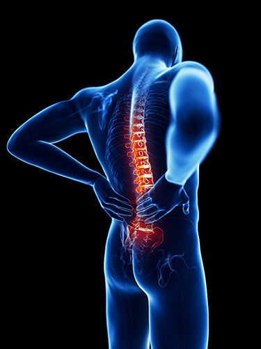 Low Back Pain