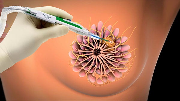 EnVisio breast implantation